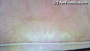 [P11] Alta saltea dar aceiasi stare avanzata de infectie.  » foto by kristy_
 - 
<span class="allrVoted glyphicon glyphicon-heart hidden" id="av653988"></span>
<a class="m-l-10 hidden" id="sv653988" onclick="voting_Foto_DelVot(,653988,858)" role="button">șterge vot <span class="glyphicon glyphicon-remove"></span></a>
<a id="v9653988" class=" c-red"  onclick="voting_Foto_SetVot(653988)" role="button"><span class="glyphicon glyphicon-heart-empty"></span> <b>LIKE</b> = Votează poza</a> <img class="hidden"  id="f653988W9" src="/imagini/loader.gif" border="0" /><span class="AjErrMes hidden" id="e653988ErM"></span>