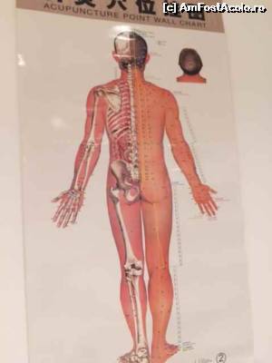 [P33] cabinetul de acupunctura » foto by denisse
 - 
<span class="allrVoted glyphicon glyphicon-heart hidden" id="av623741"></span>
<a class="m-l-10 hidden" id="sv623741" onclick="voting_Foto_DelVot(,623741,7539)" role="button">șterge vot <span class="glyphicon glyphicon-remove"></span></a>
<a id="v9623741" class=" c-red"  onclick="voting_Foto_SetVot(623741)" role="button"><span class="glyphicon glyphicon-heart-empty"></span> <b>LIKE</b> = Votează poza</a> <img class="hidden"  id="f623741W9" src="/imagini/loader.gif" border="0" /><span class="AjErrMes hidden" id="e623741ErM"></span>